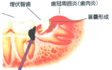 症状・状況による時