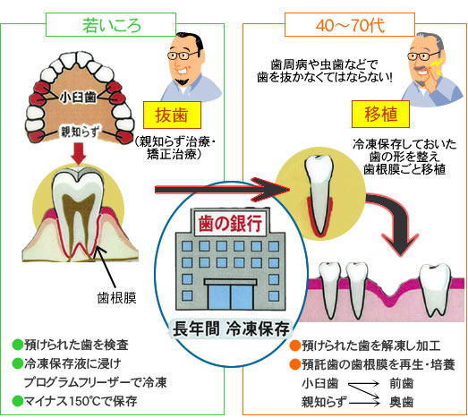 歯の銀行(ティースバンク)のしくみ