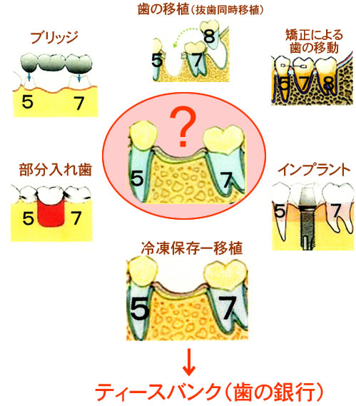 あなたはどの治療を選択しますか?
