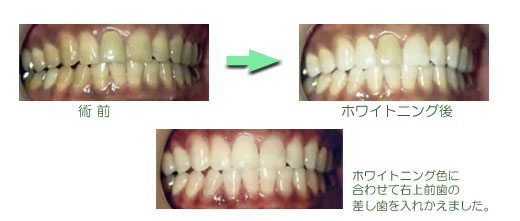 40代・女性